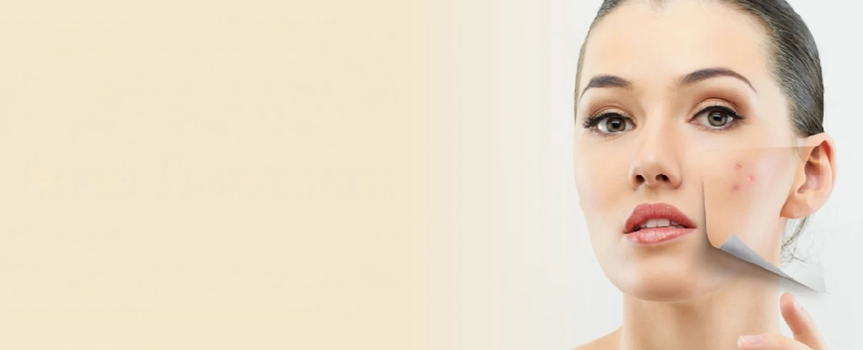 acne scars treatment, skincare