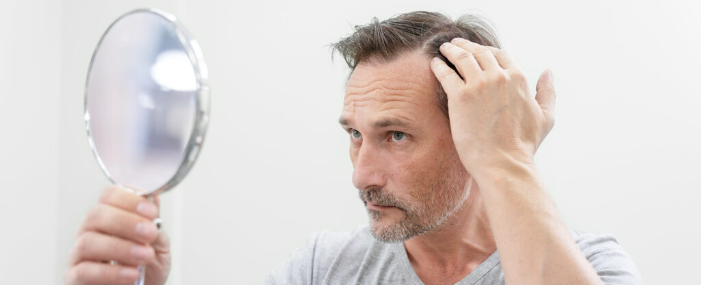 Hair Transplantation Treatament