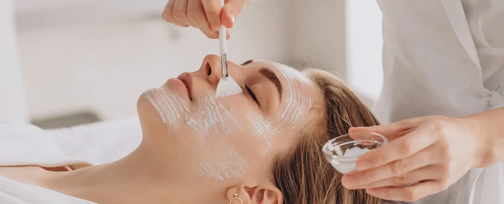 chemical peel treatment