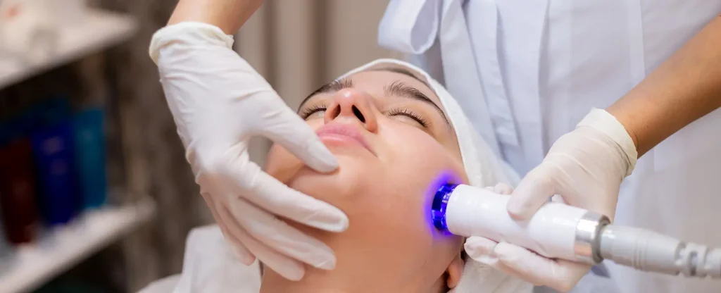 photodynamic therapy for acne
