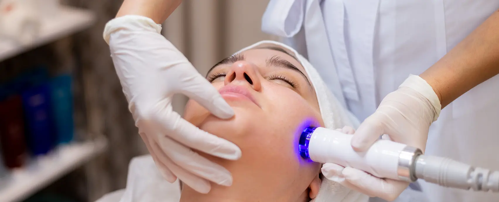 photodynamic therapy for acne