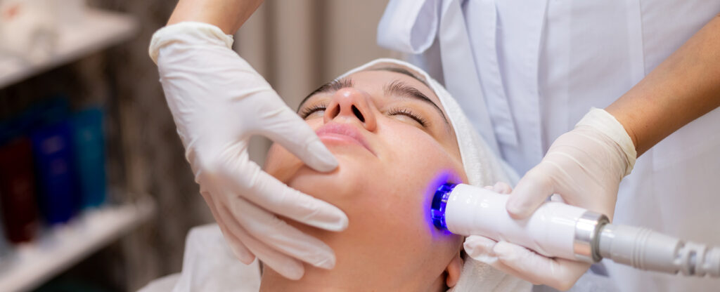 photodynamic therapy for acne