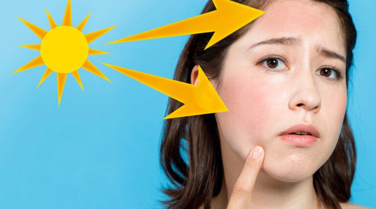 Read more about the article Professional Tan Removal Treatment for Radiant Skin