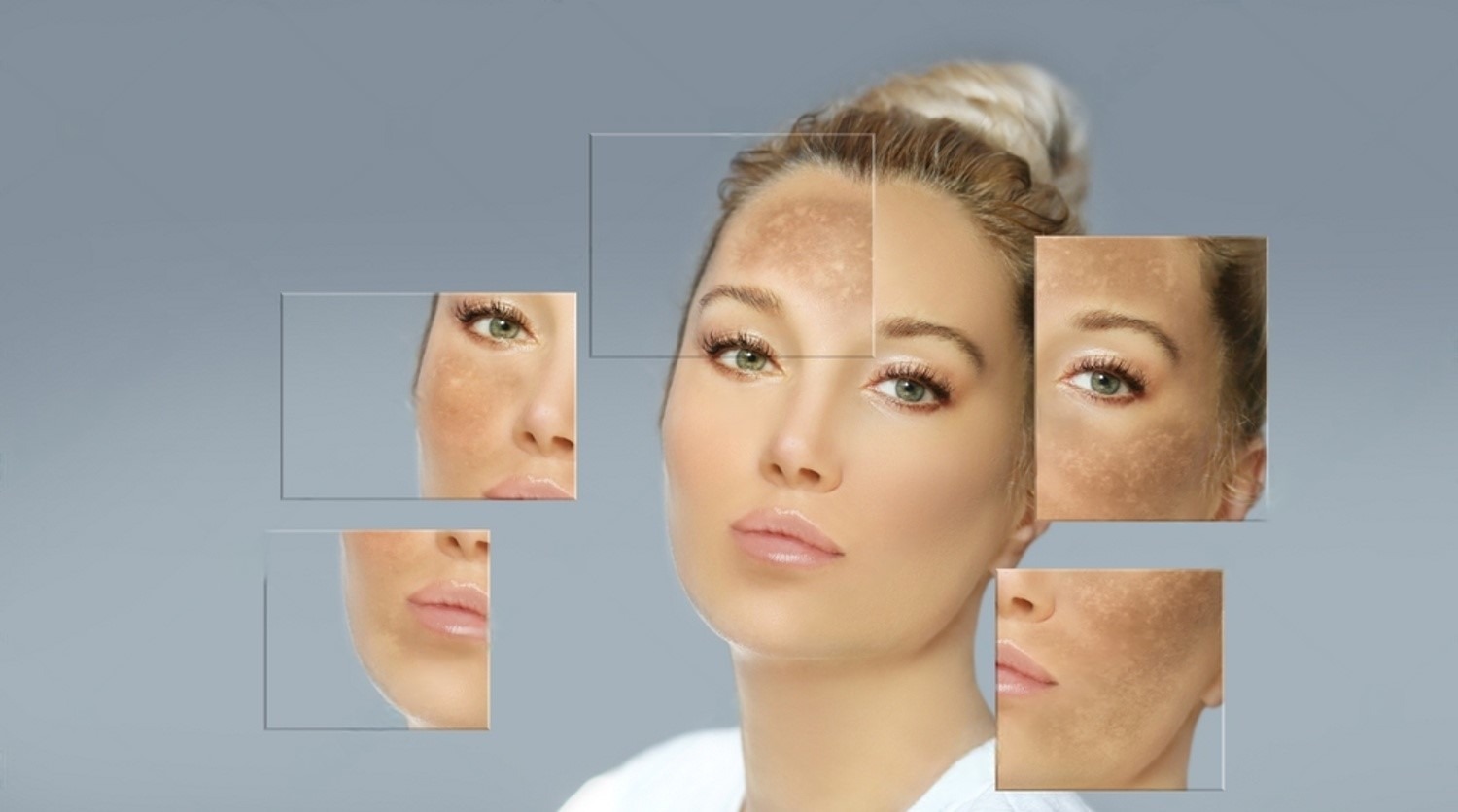 Expert Tips to Reduce Dark Spots & Hyperpigmentation