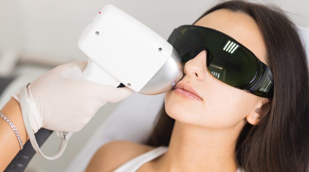 facial laser hair removal