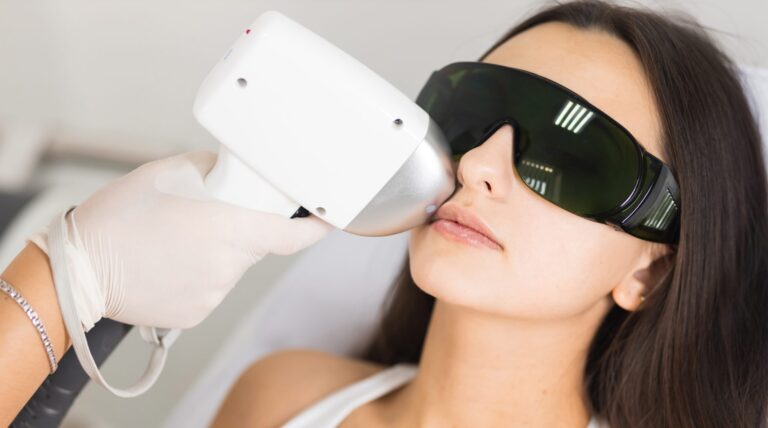 facial laser hair removal