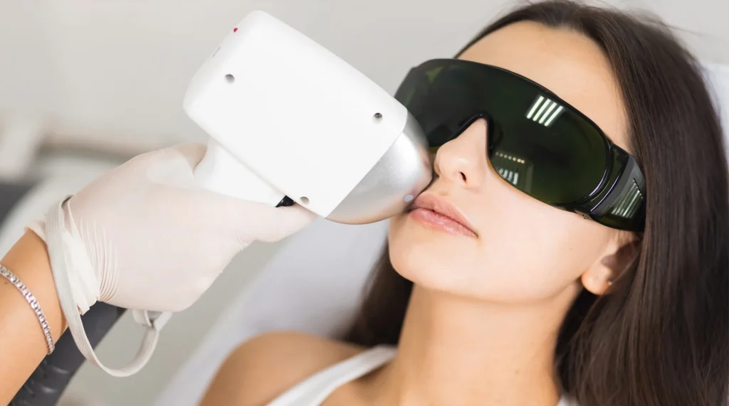 facial laser hair removal