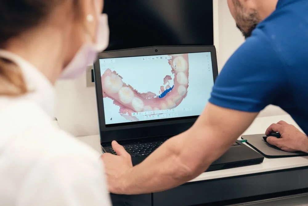 3D digital scan aligner simulation