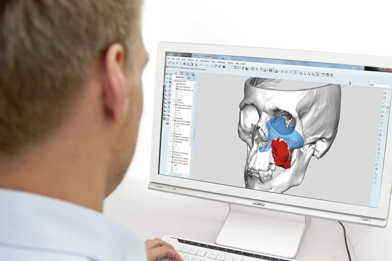 3D virtual planning orthognathic