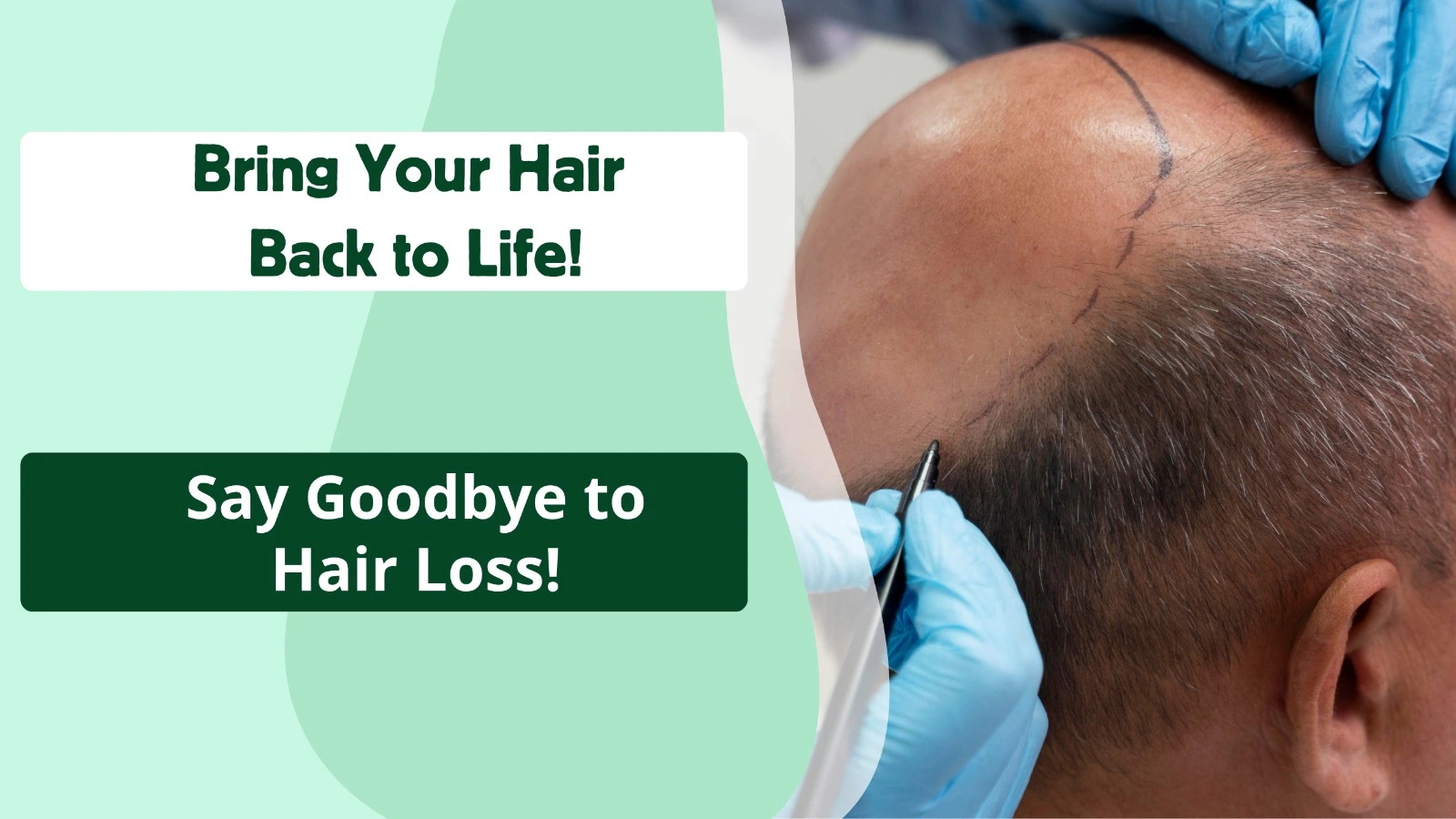 Best Hair regrowth center in vijayawada