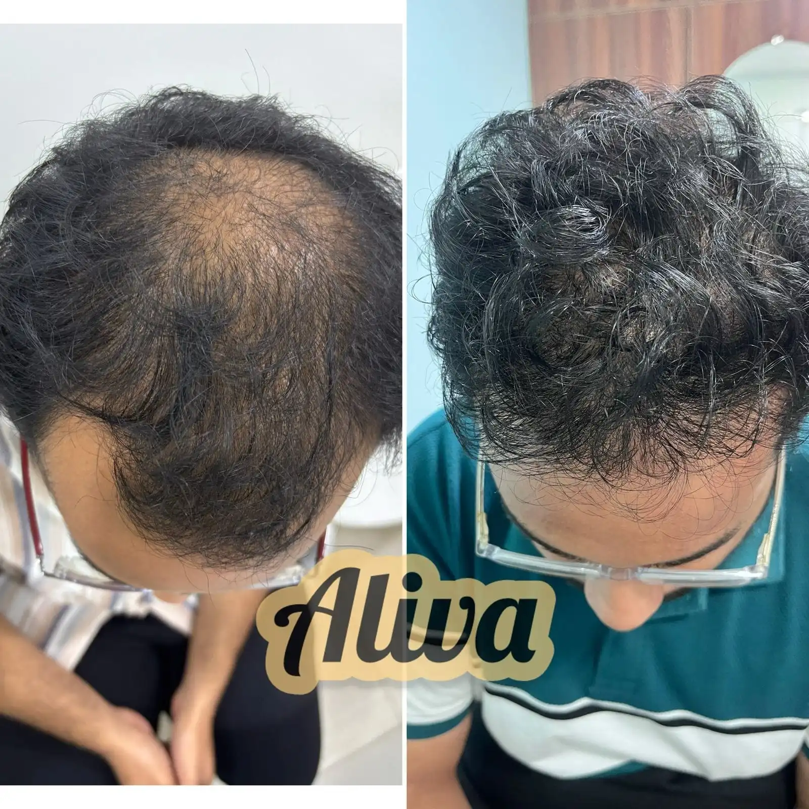 Hair treatment before and after result