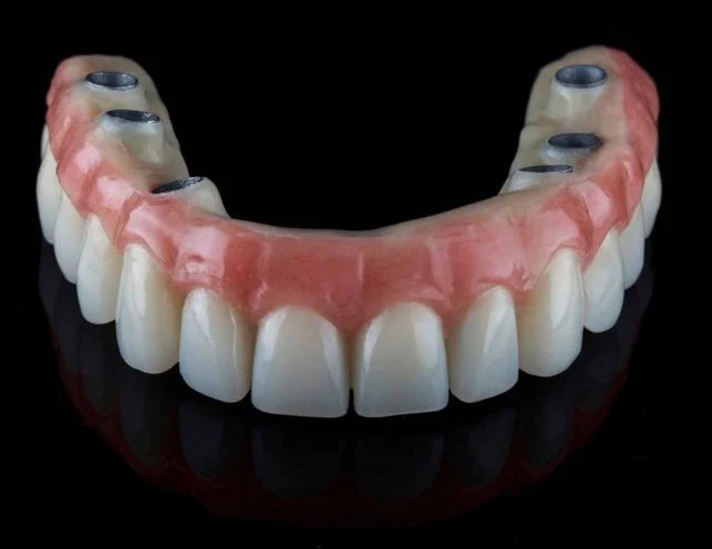 All-on-4 All-on-6 dental implants