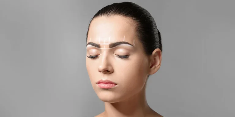 Gravitational facial tissue sagging