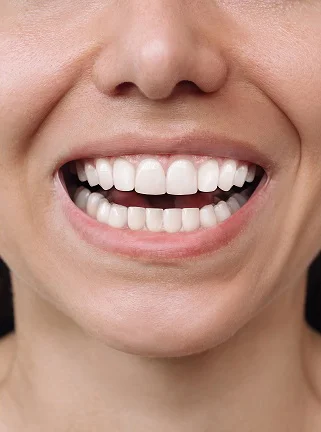 After denture treatment