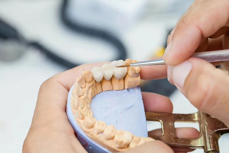 Crown fabrication dental lab