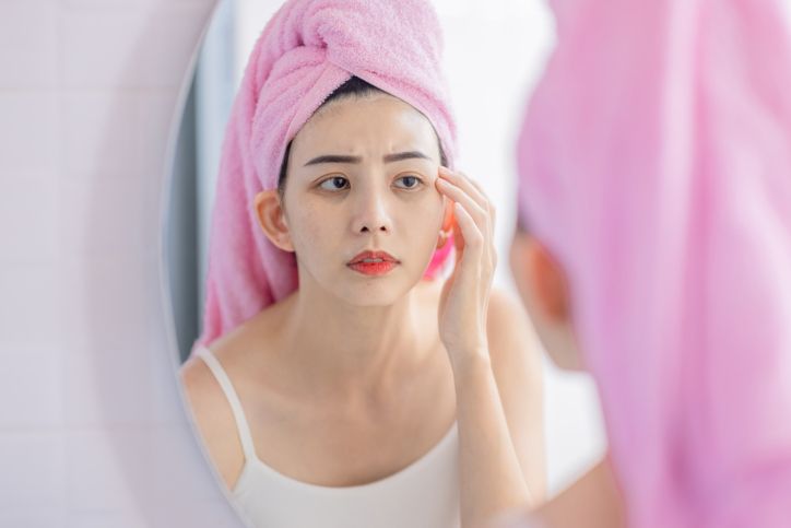 Vascular pooling blue dark circles