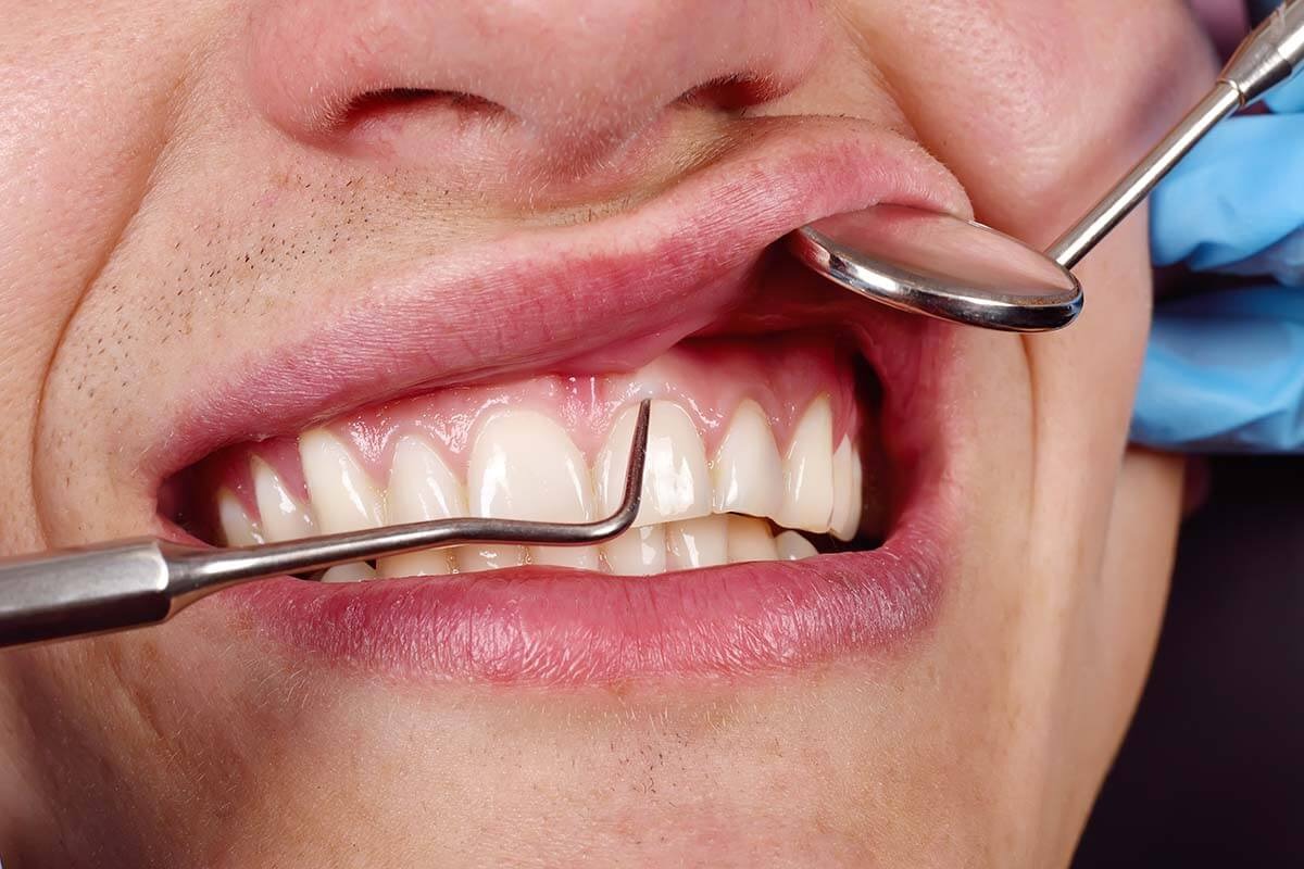 Expert dental care at Aliva Aesthetics Vijayawada
