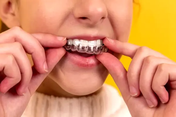 Dental consultation at Aliva Aesthetics Vijayawada