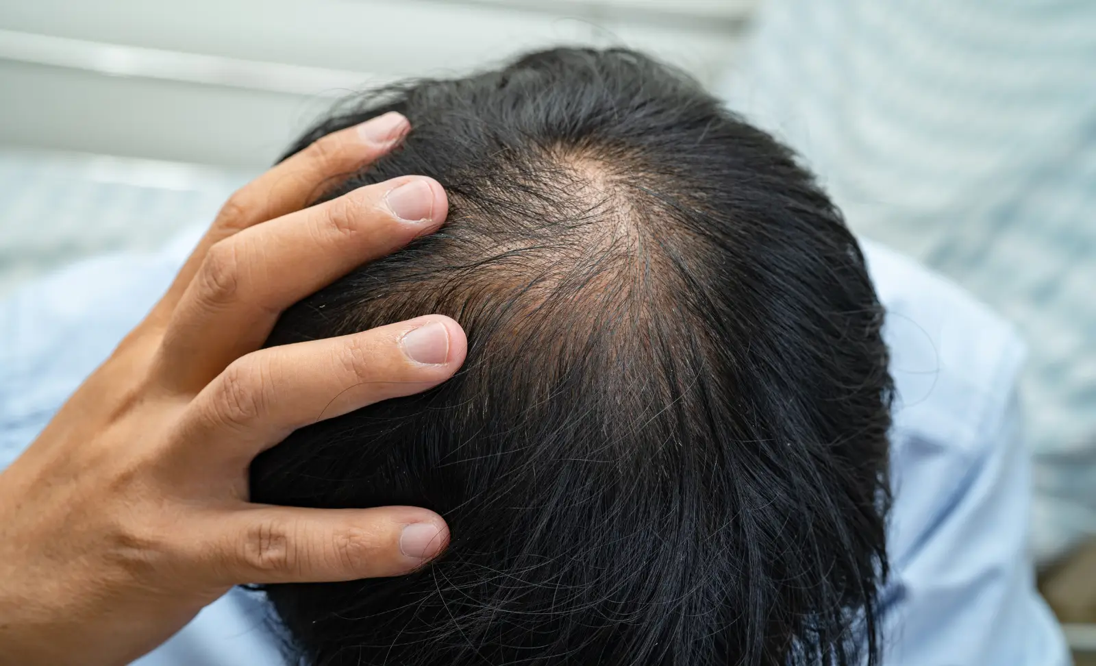 Weak miniaturised hair strand strengthening treatment