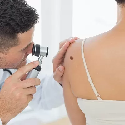 Expert Assessment & Dermoscopy — Skin Tags & Warts at Aliva Aesthetics
