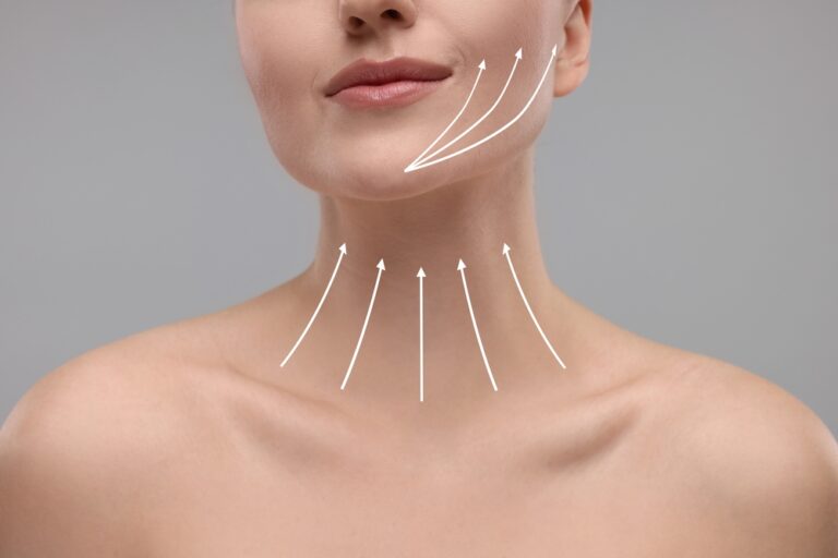HIFU face and neck complete treatment