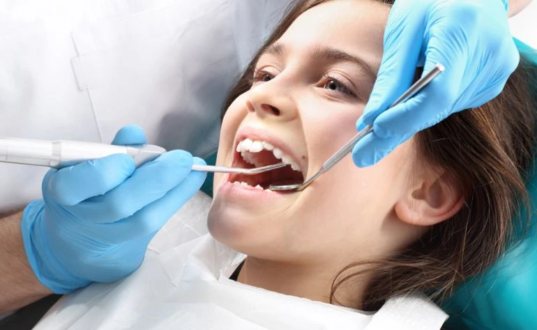 Fluoride application filling dental