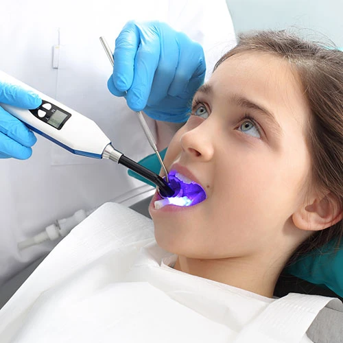 Fluoride sealing prevention dental