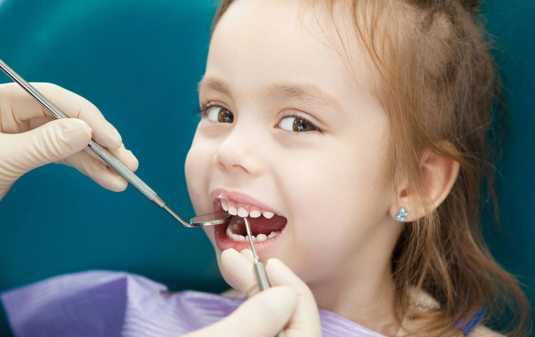 Fluoride varnish kids teeth