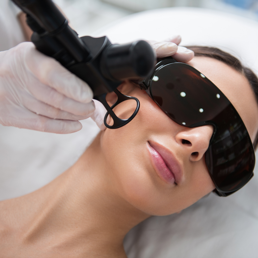 CO2 Laser Removal — Skin Tags & Warts at Aliva Aesthetics
