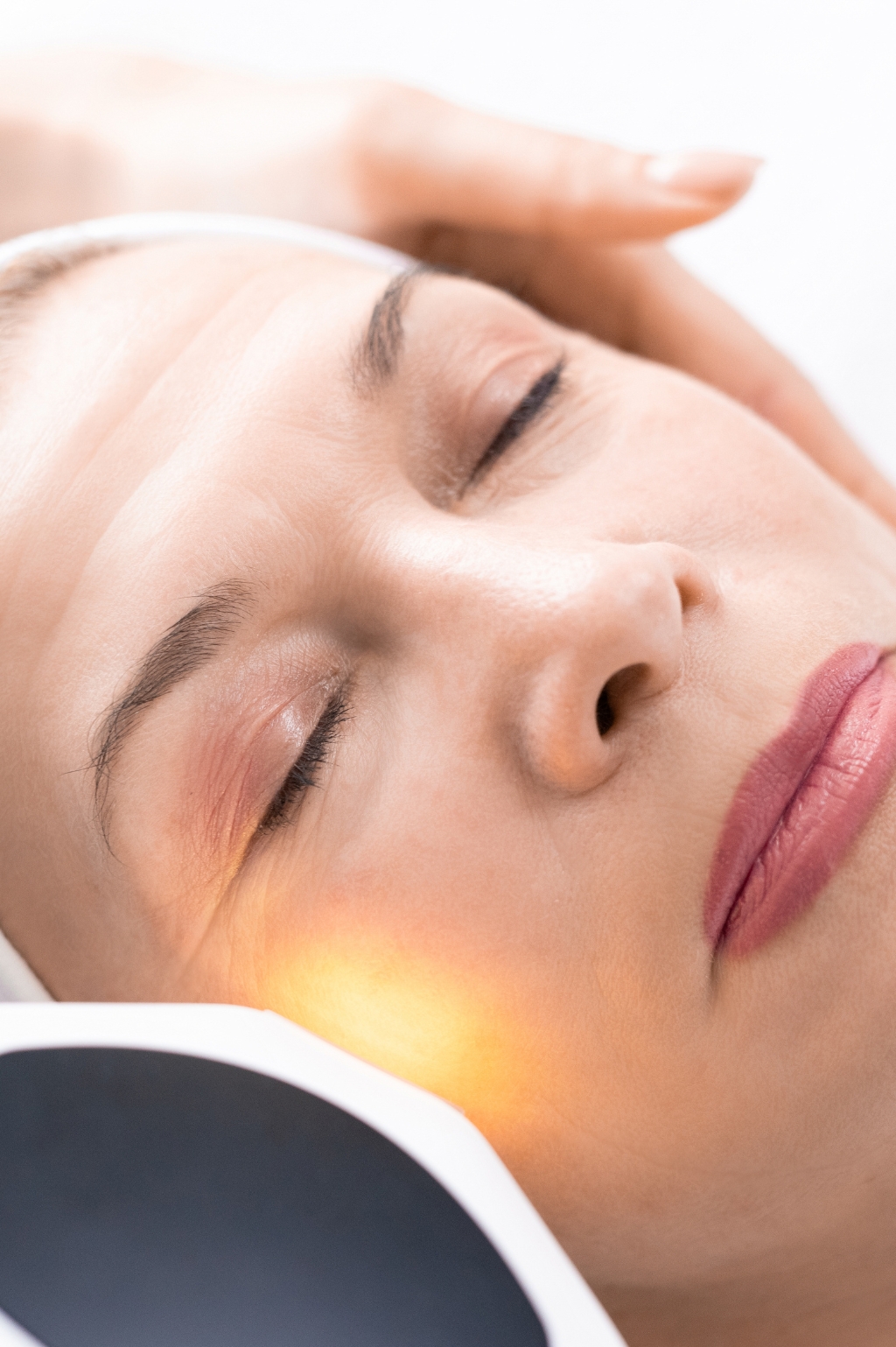 Fractional laser skin resurfacing procedure