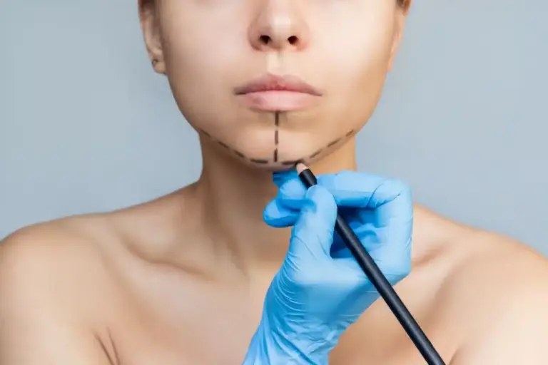 Genioplasty add-on jaw surgery