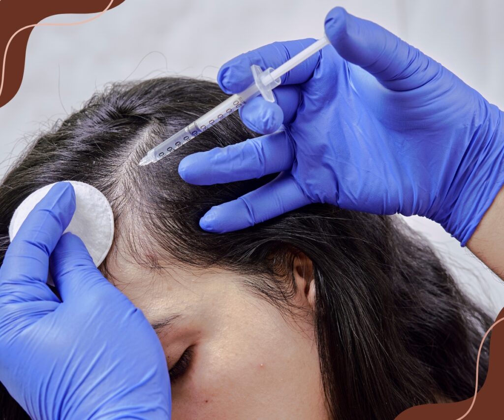 GFC growth factor scalp injection therapy