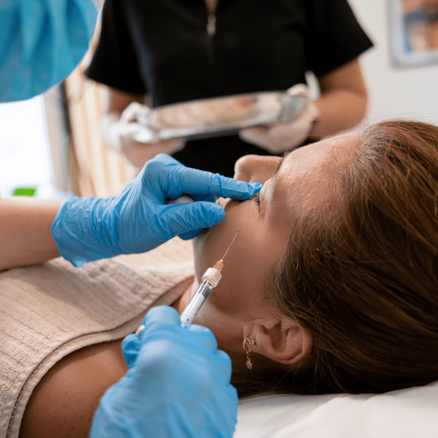 Best Pigmentation Treatment in Vijayawada