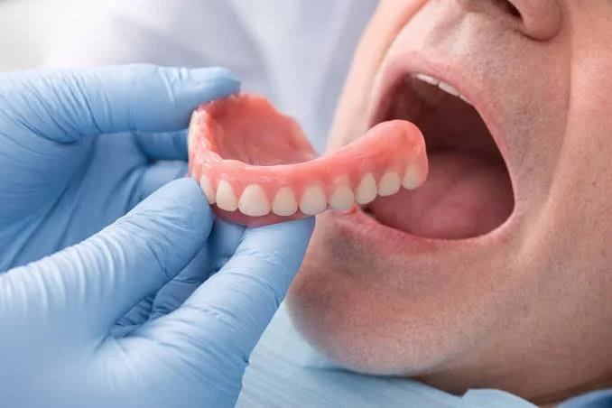 Immediate dentures