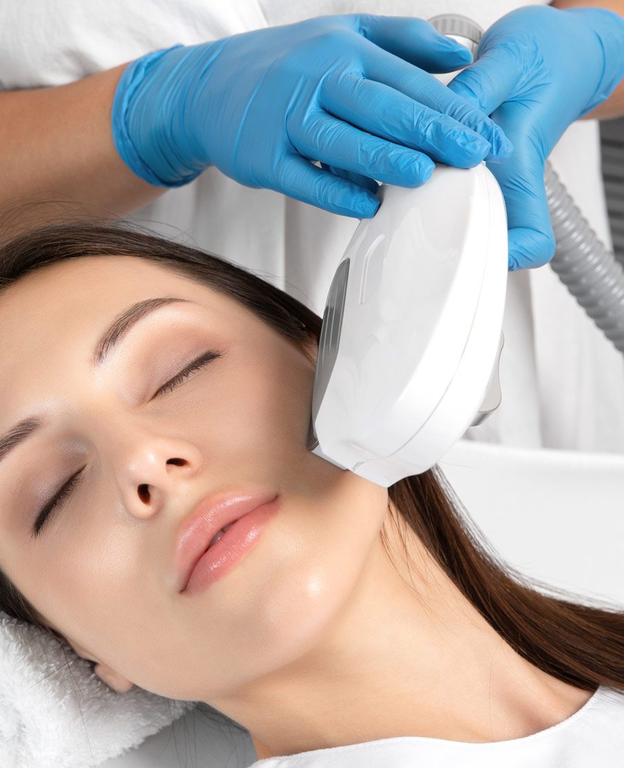 IPL intense pulsed light pigmentation
