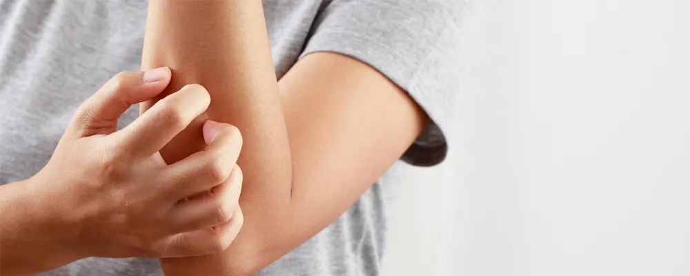 Inverse Psoriasis — Psoriasis