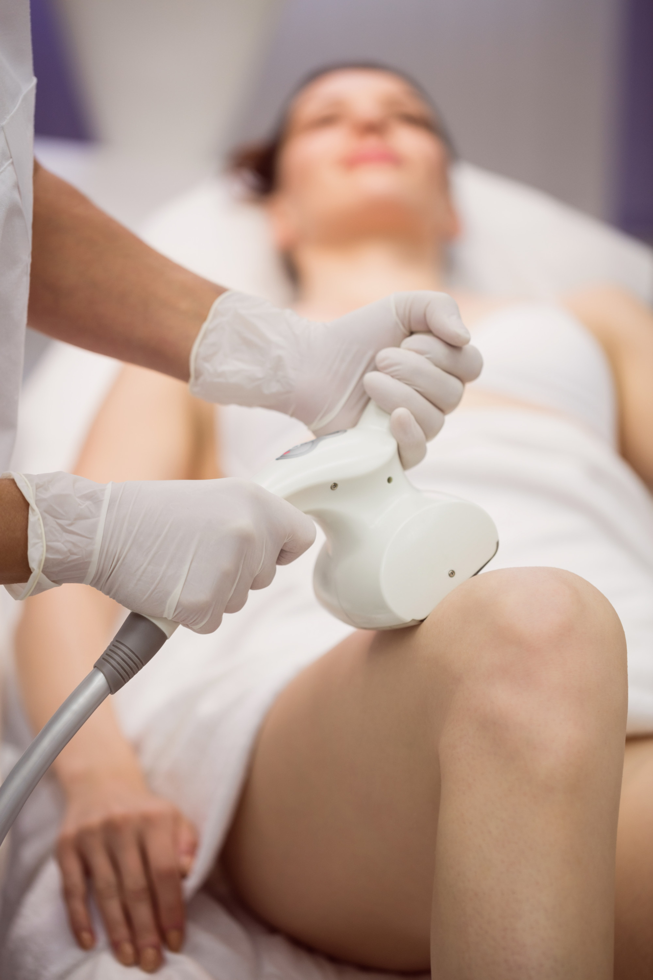 Laser toning body pigmentation treatment