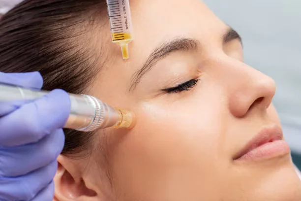 Microneedling serum hair loss therapy