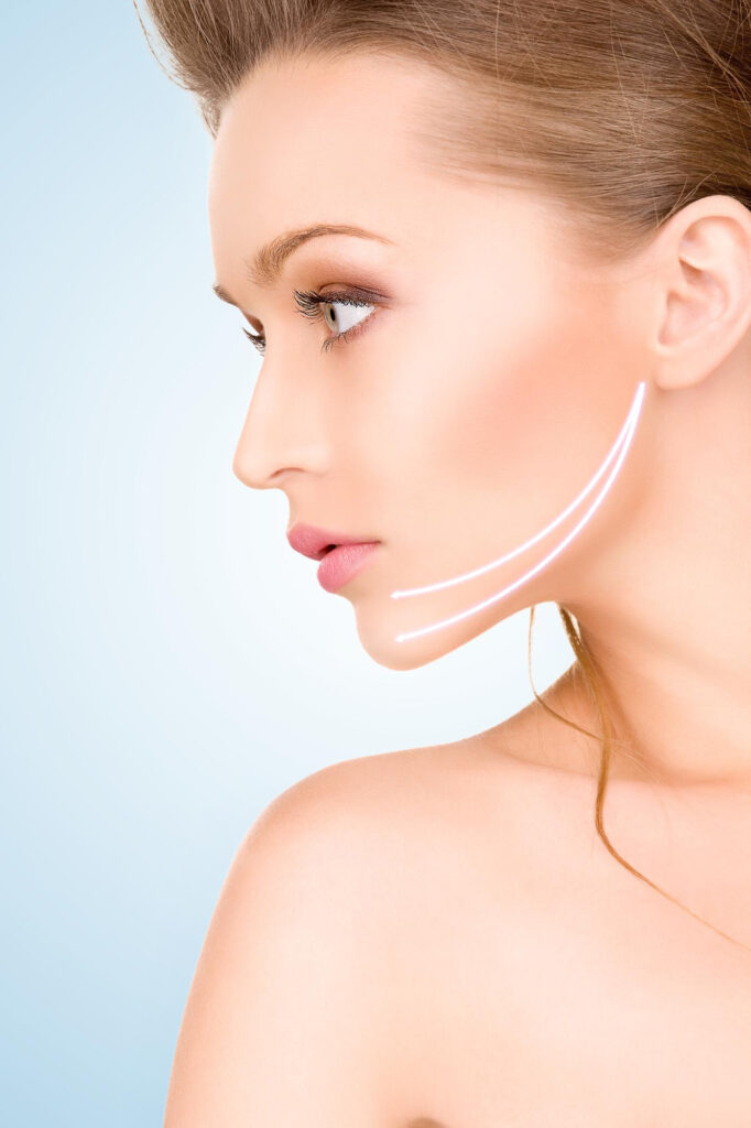 HIFU neck and jaw contouring treatment