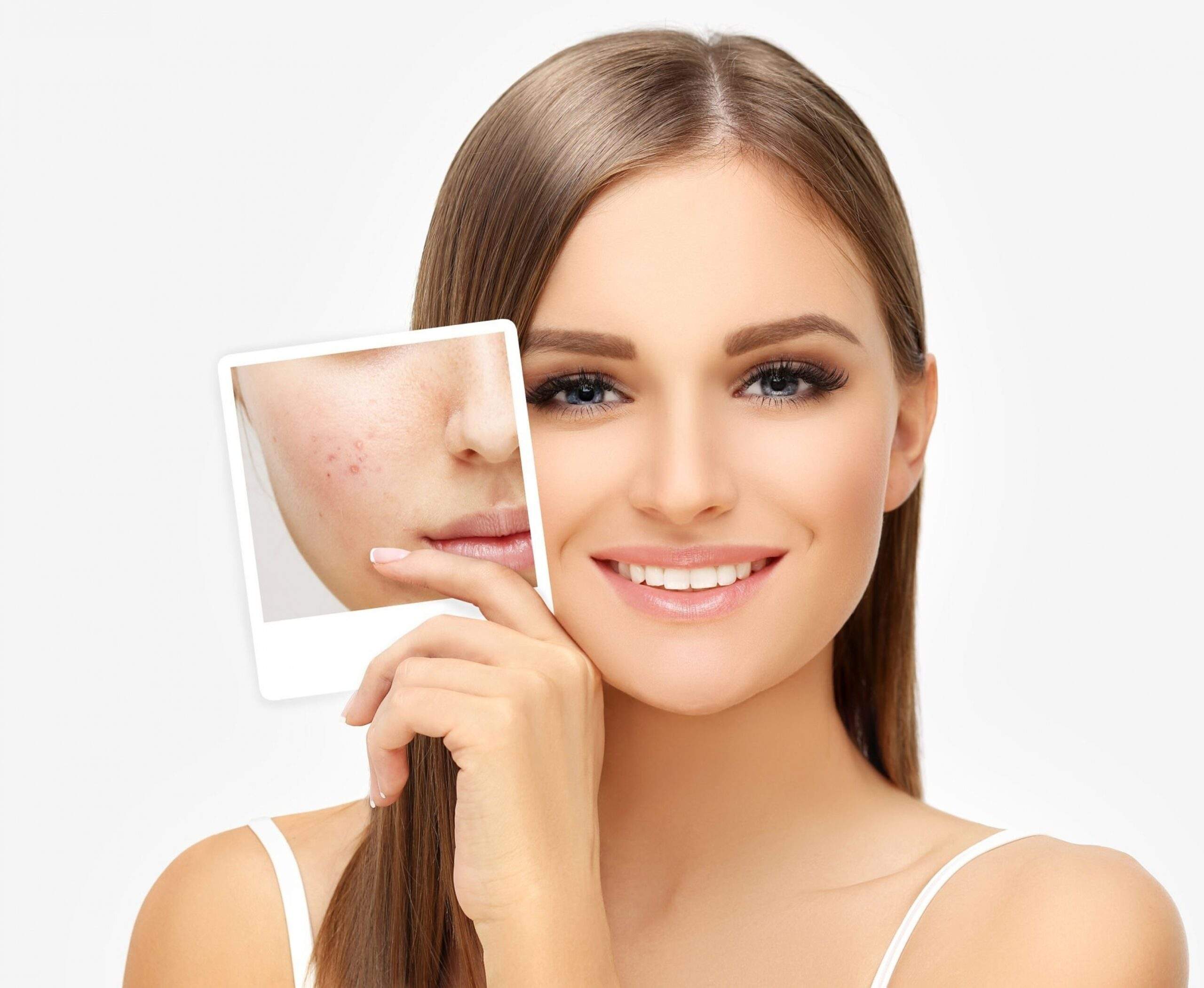 Pigmentation Treatment at Aliva Aesthetics Vijayawada
