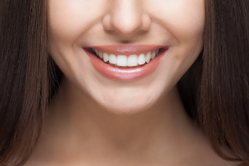Professional whitening smile