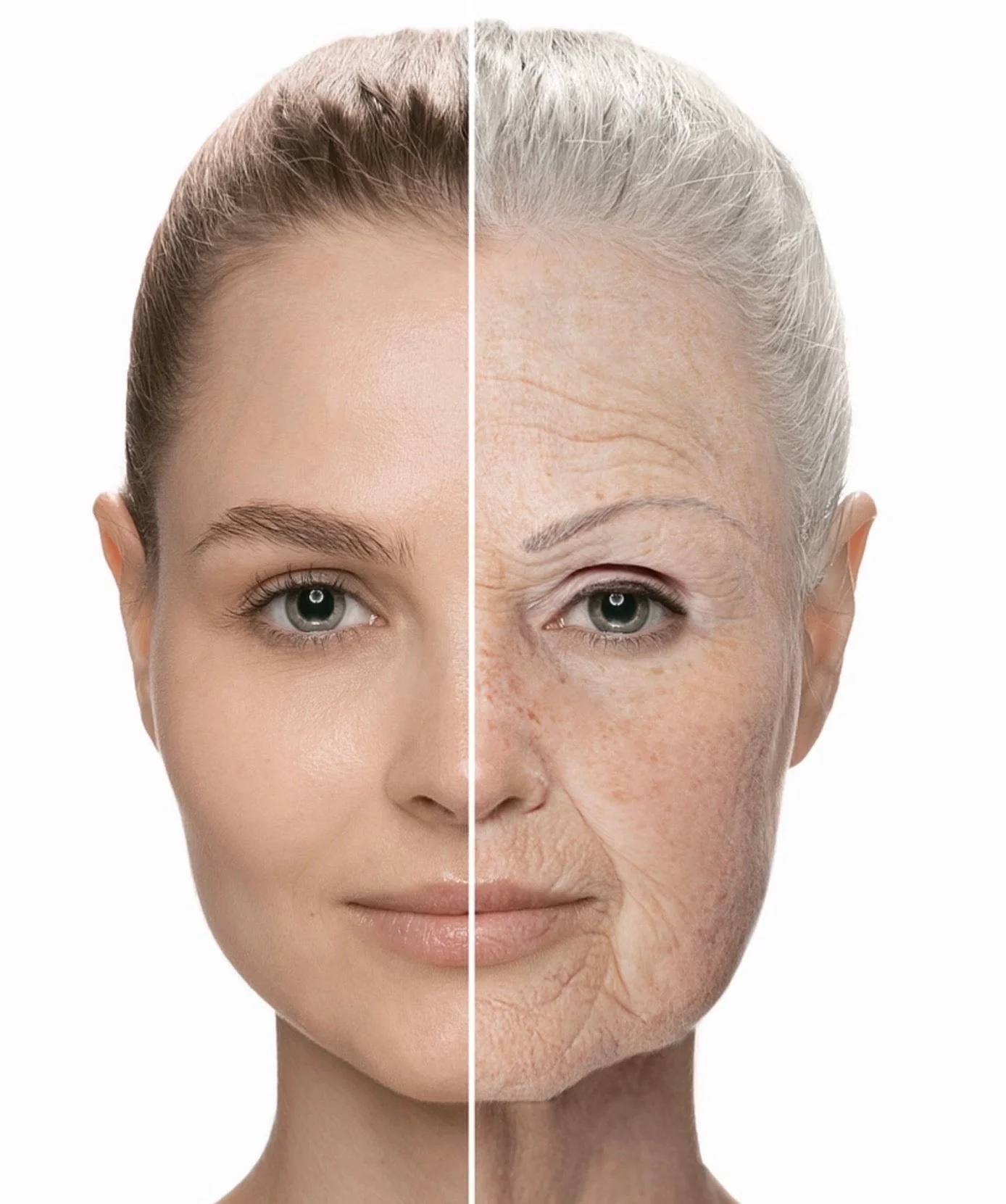 Profhilo skin booster microinjection treatment
