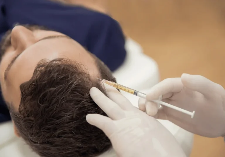 PRP GFC hair transplant recovery add-on