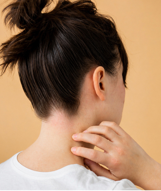 After psoriasis treatment