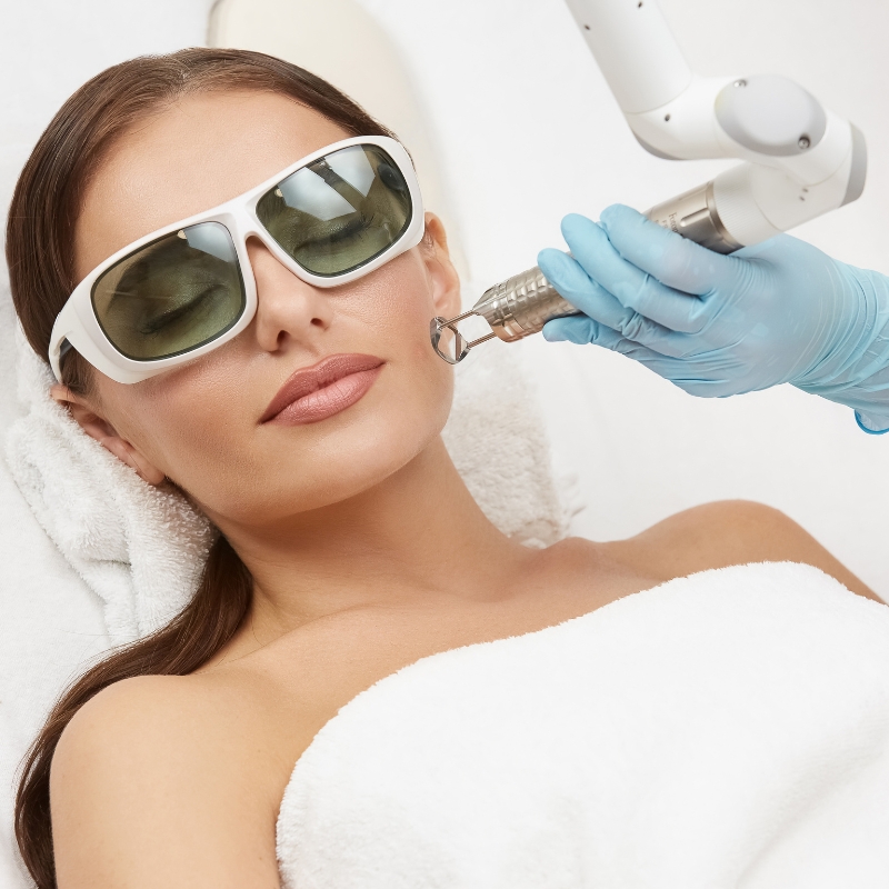 Q-switched laser toning pigmentation treatment