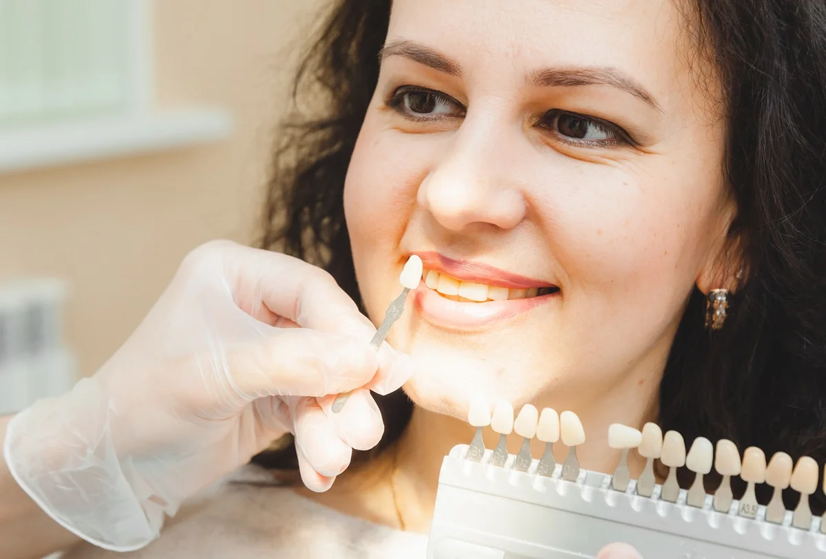 Smile design consultation digital