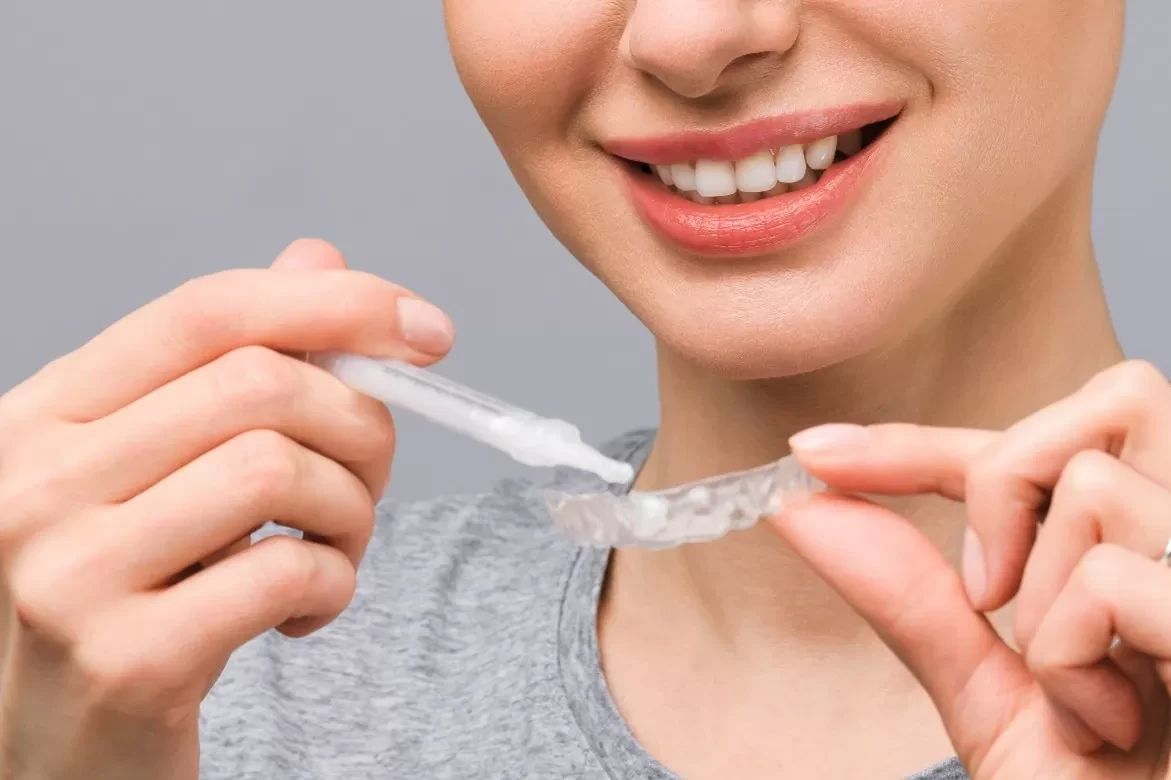 Take-home whitening trays custom