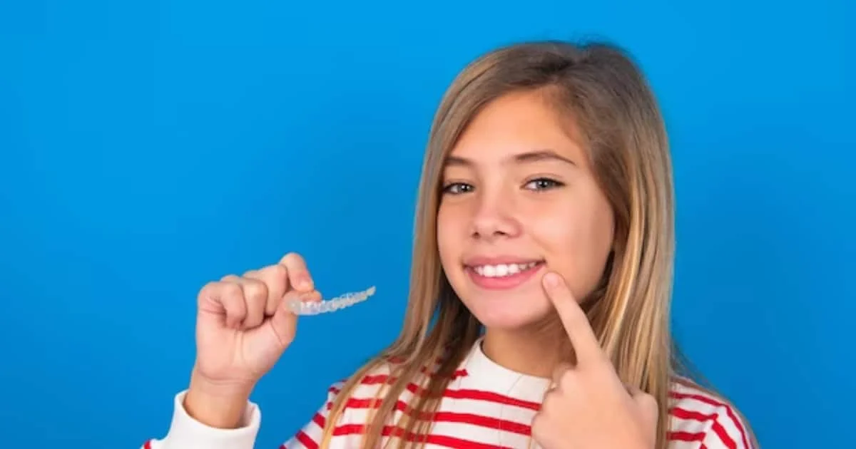 Teen-friendly clear aligners