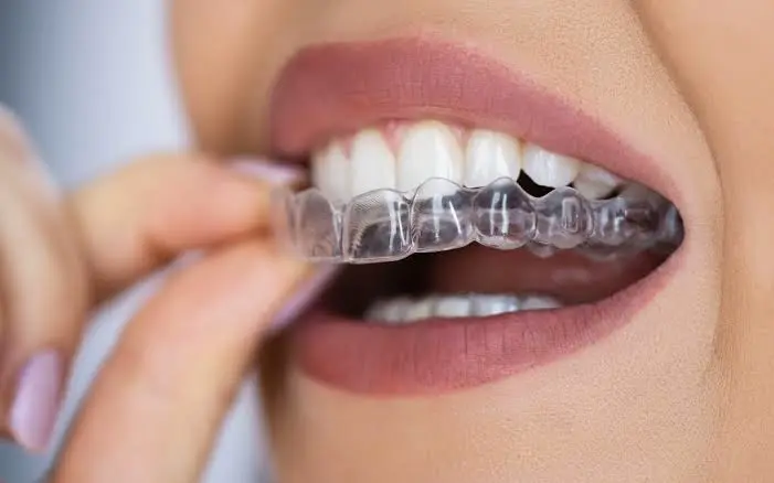 Tooth Aligners