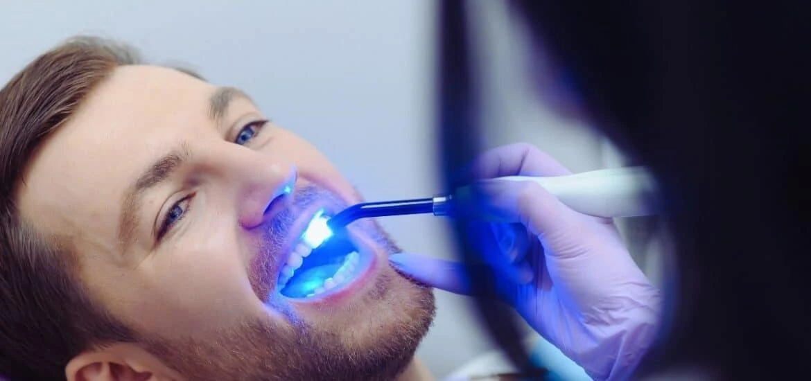 Touch-up whitening maintenance